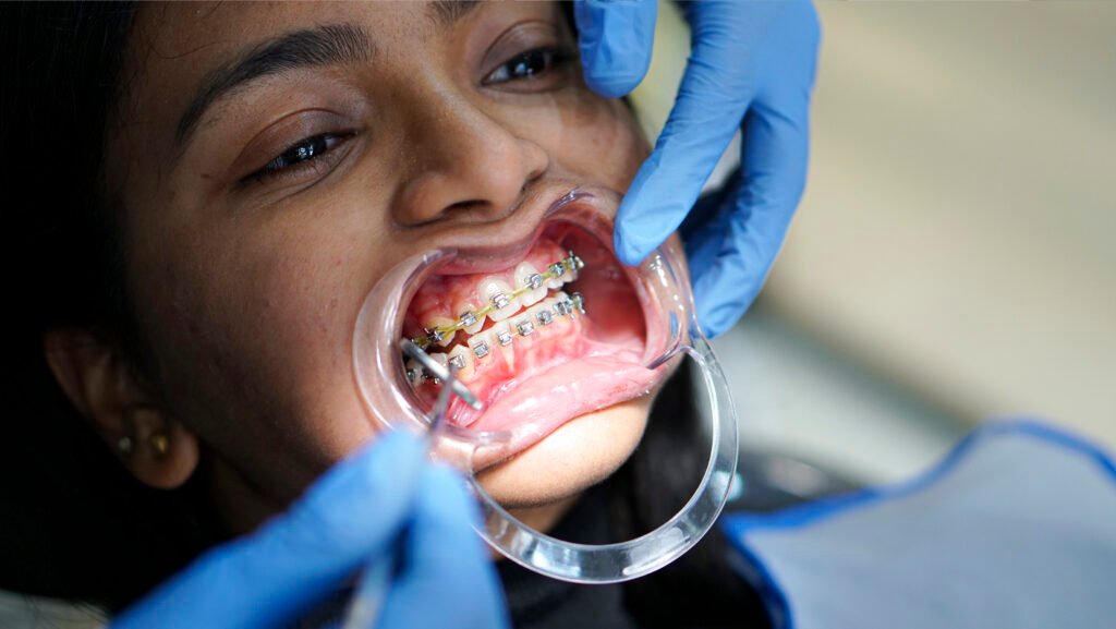 Orthodontics