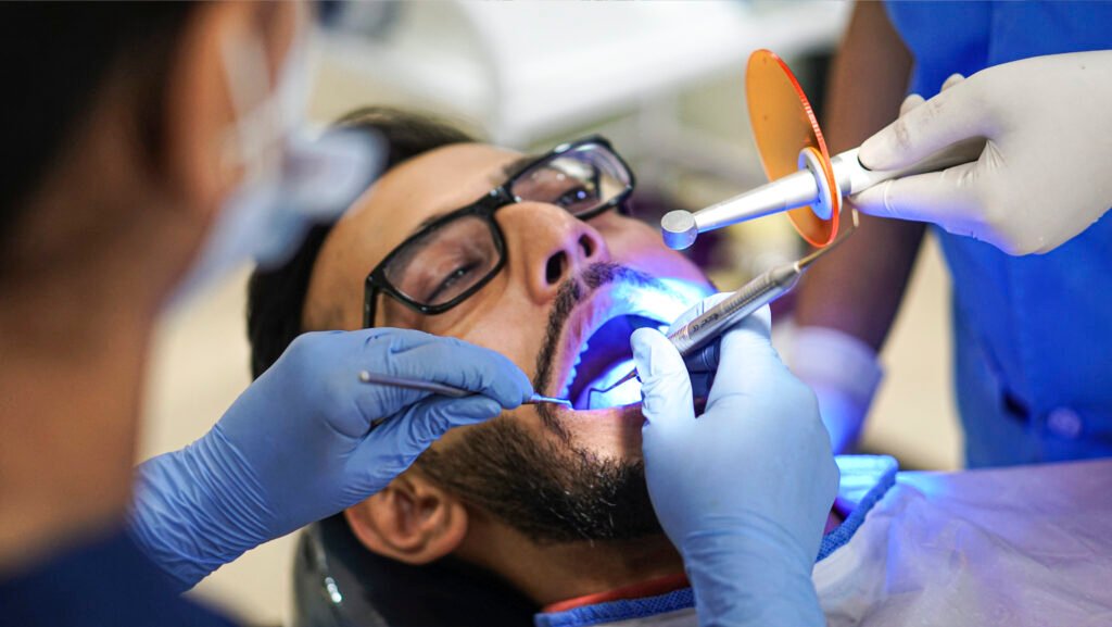 Dental Fillings
